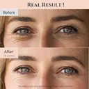 Beauty Of Joseon Revive Augenserum mit Ginseng & Retinal, 30 ml image 9